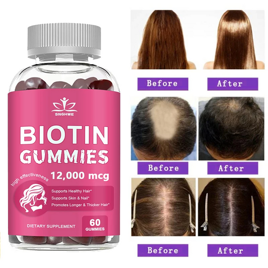 4-in-1 Collagen + Biotin Gummies for Women & Men