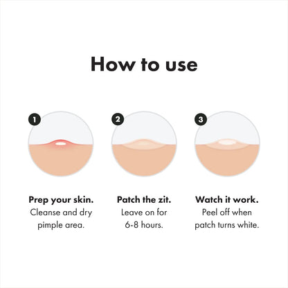 Mighty Patch™ Original – Hydrocolloid Acne Patches