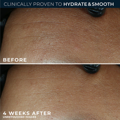RoC Retinol Correxion Max Daily Hydration