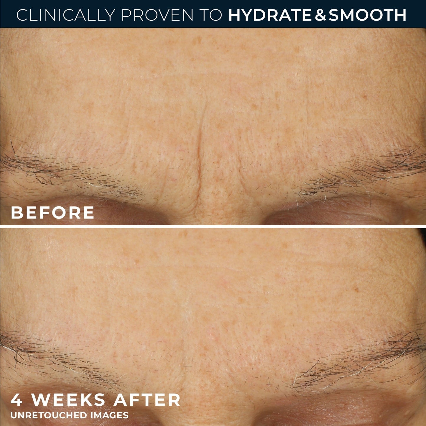 RoC Retinol Correxion Max Daily Hydration