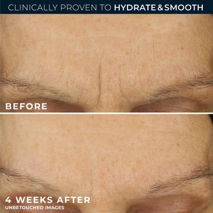 RoC Retinol Correxion Max Daily Hydration